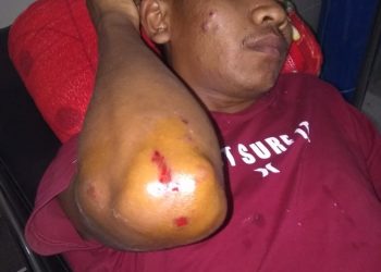 Empat Pria Bercadar Keroyok Dua Pemuda Sampai Babak Belur‎