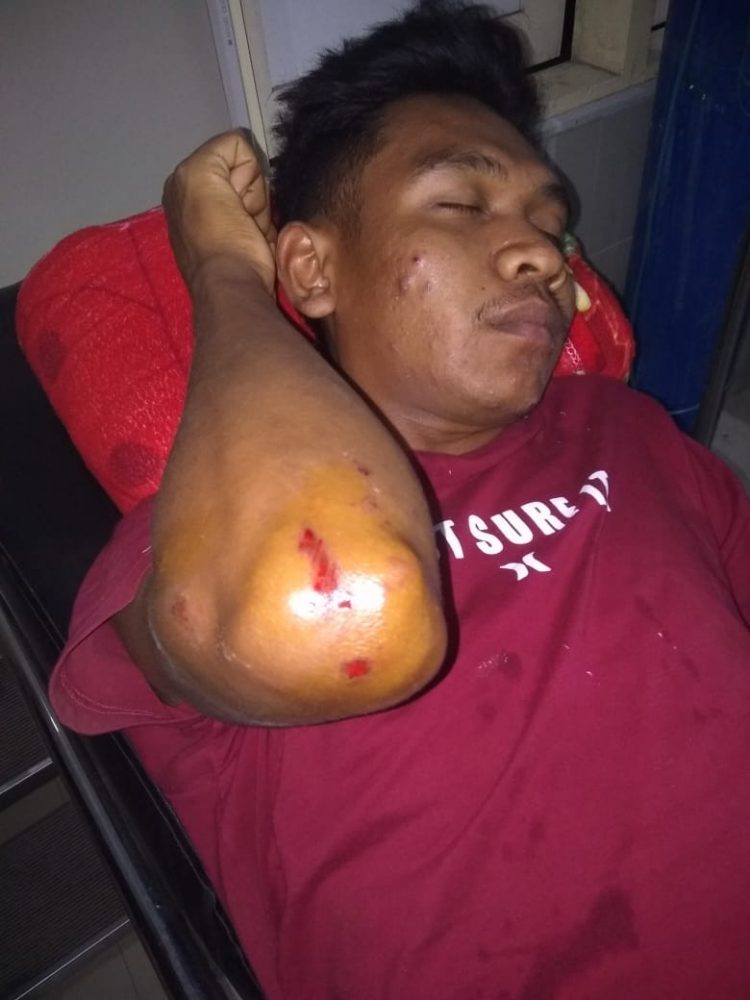 Empat Pria Bercadar Keroyok Dua Pemuda Sampai Babak Belur