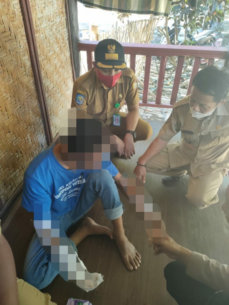 Pasang Regulator Gas LPG, Dua Jadi Korban Disambar Api Di Sambelia