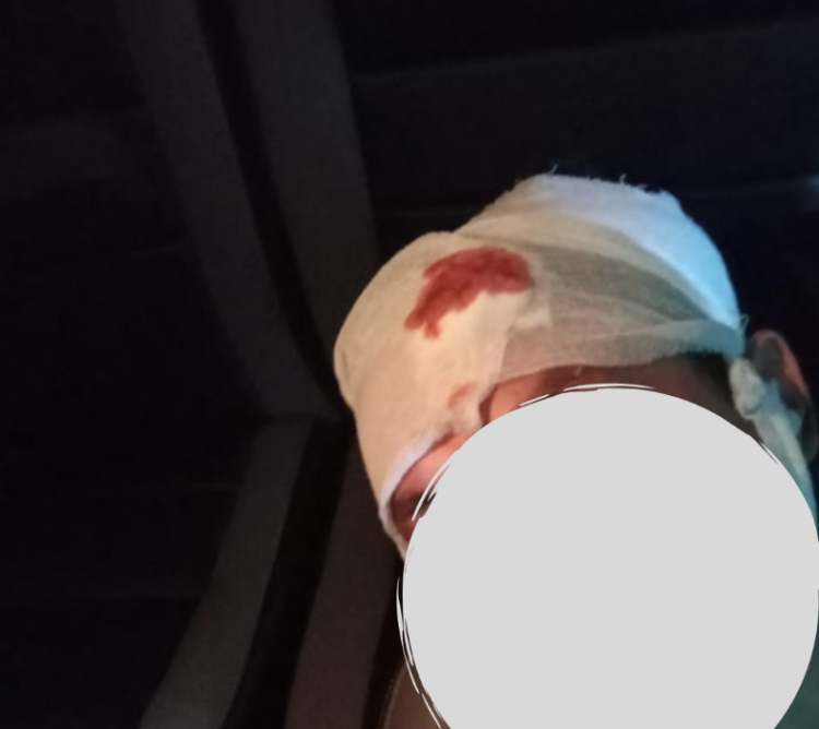 Aktivis di NTB Jadi Korban Aniaya, Berharap Pelaku Segera Diringkus