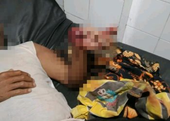 Akibat Ledakan Petasan, Tangan Warga di Loteng Hancur Hingga Diamputasi