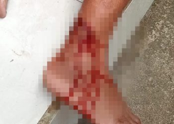 Habis Lebaran, Lutung Kembali Mengamuk, Gigit Kaki Warga Montong Gading