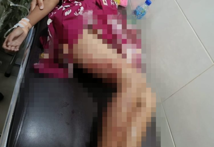 Pulang Ngaji, Pelajar SD di Lotim Diserang Dua Anjing Liar Hingga Dilarikan ke UGD