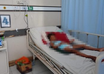 Siswa SD di Lotim Diduga Jadi Korban Perundungan, Alami Memar hingga Patah Tulang