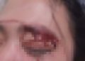 Oknum Sopir MBG di Lotim Diduga Pukul Istri Hingga Babak Belur